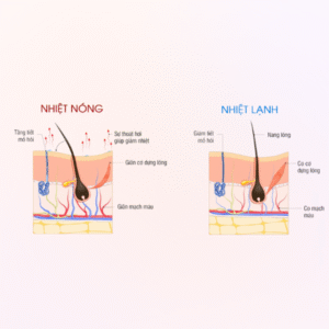 Liệu pháp nhiệt